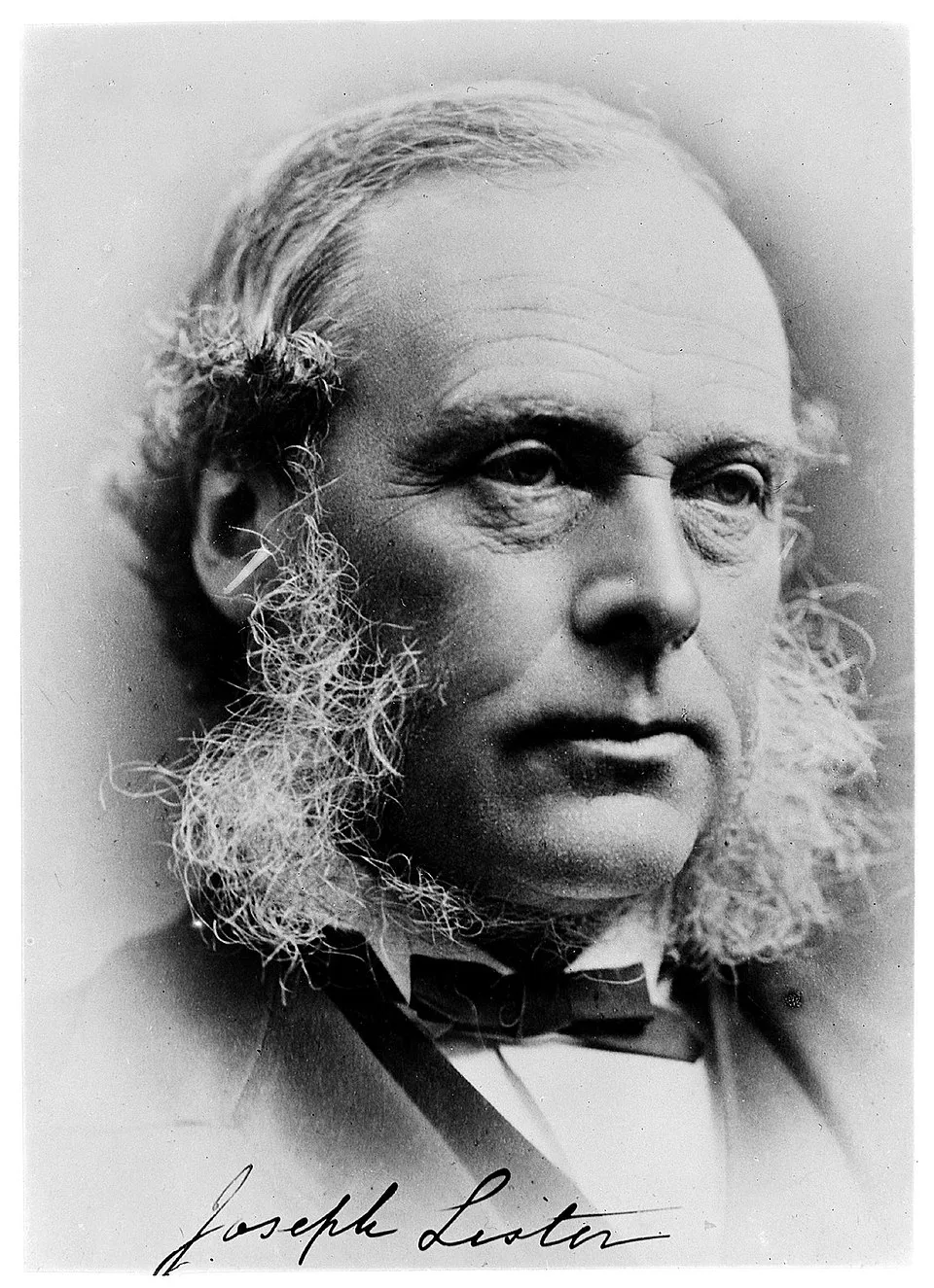 Joseph Lister fotoğrafı