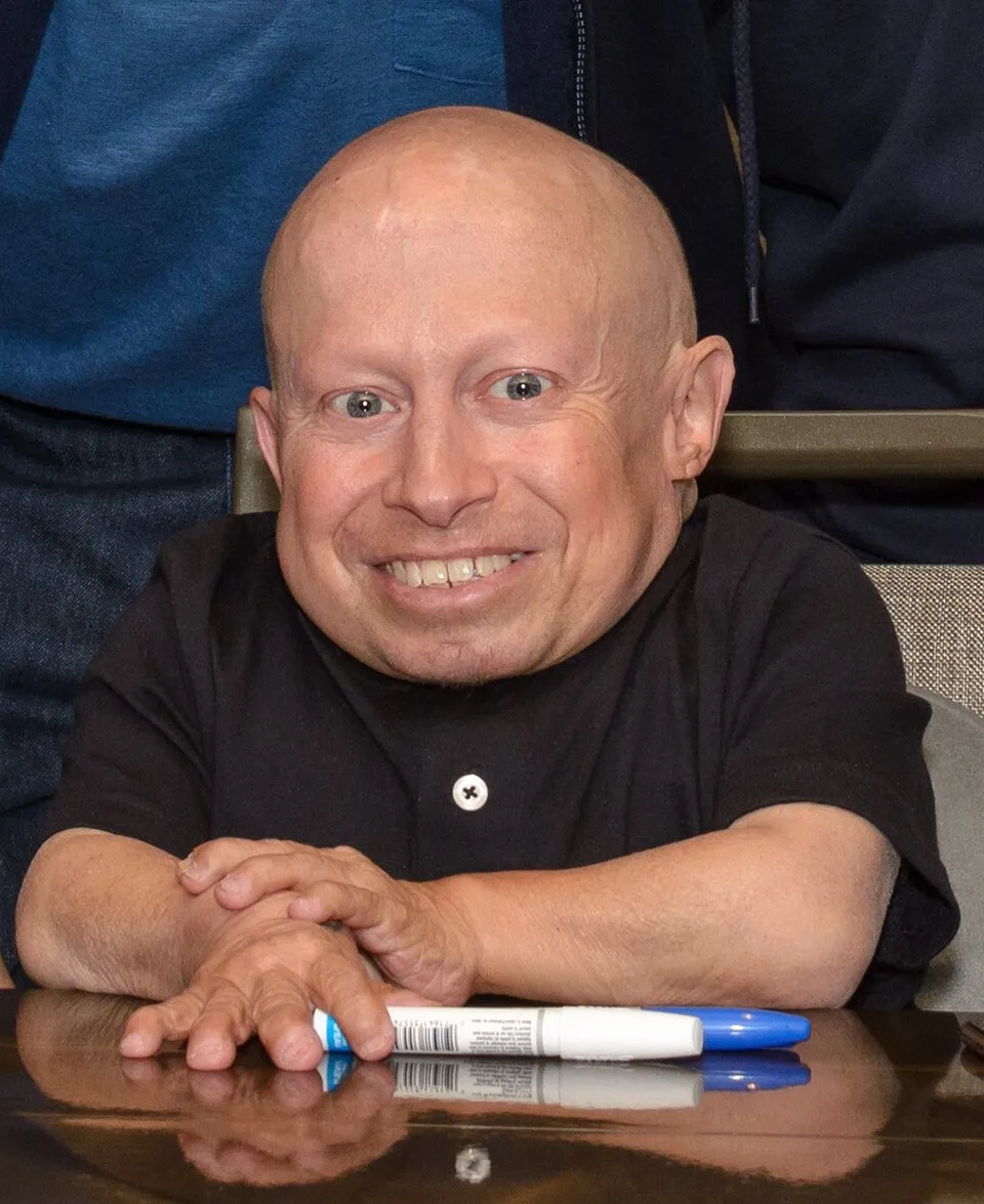 Verne Troyer fotoğrafı